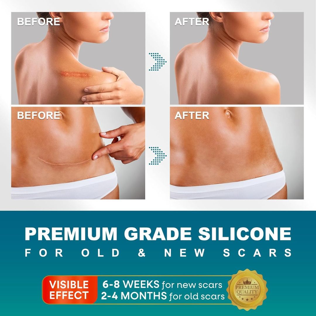 SkinSeal™ Concealer Patch